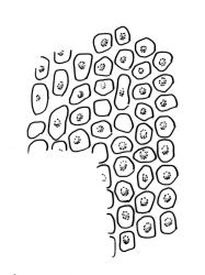 Orthotrichum graphiomitrium, upper laminal cells.
 Image: R.C. Wagstaff © All rights reserved. Redrawn with permission from Lewinsky (1984). 